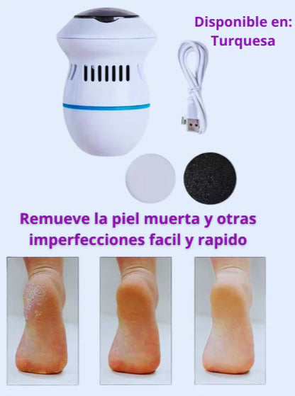Removedor de Callos USB