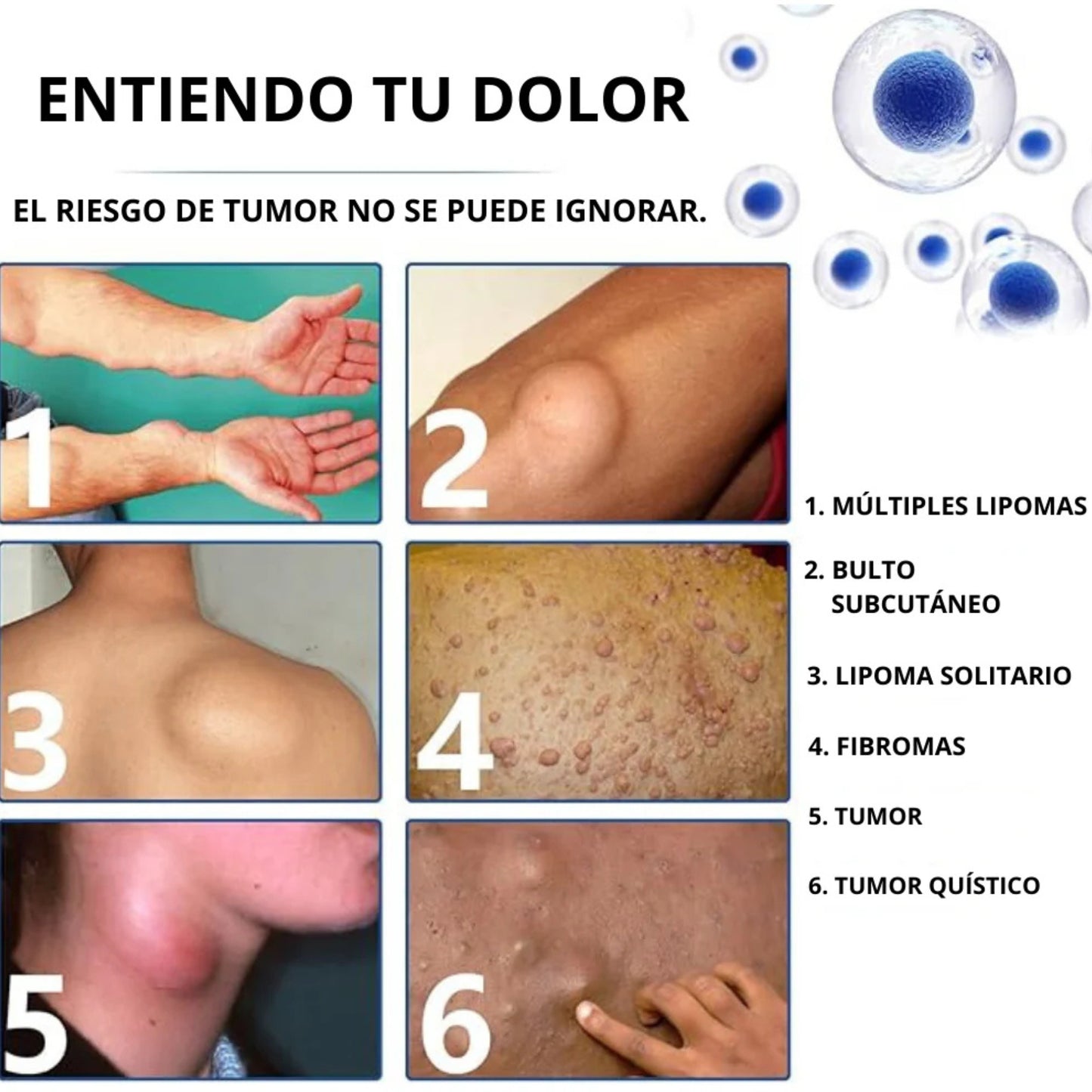 Spray Lipoma – Reduce Bultos Sin Bisturí y Desde Casa